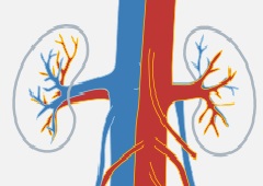 만성콩팥병(만성신부전) 치료, 동맥경화증 치료가 먼저입니다