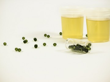 루프스(루푸스), 약으로 단백뇨를 줄인다고 해결되지 않는다