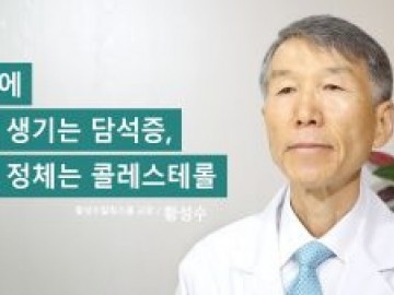 쓸개에 돌이 생기는 담석증, 돌의 정체는 콜레스테롤