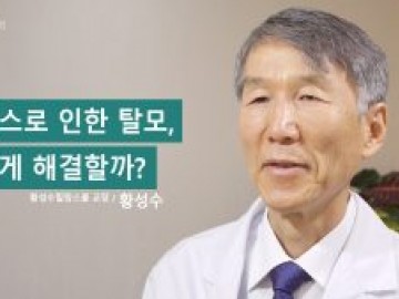 루푸스에 동반되는 탈모, 치료 어떻게 해야하나요?