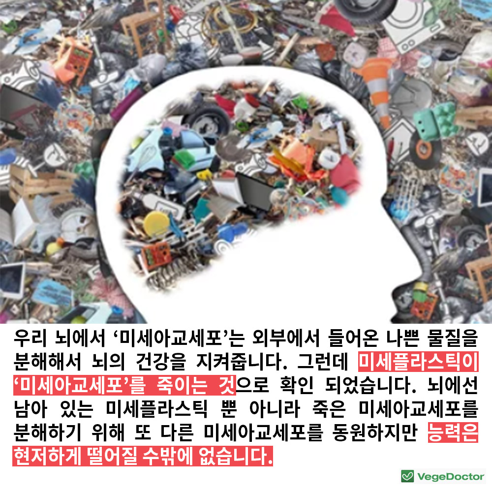 %ec%9d%bc%ed%9a%8c%ec%9a%a9%ec%bb%b5%eb%b3%b4%ec%a6%9d%ea%b8%88%ec%a0%9c5